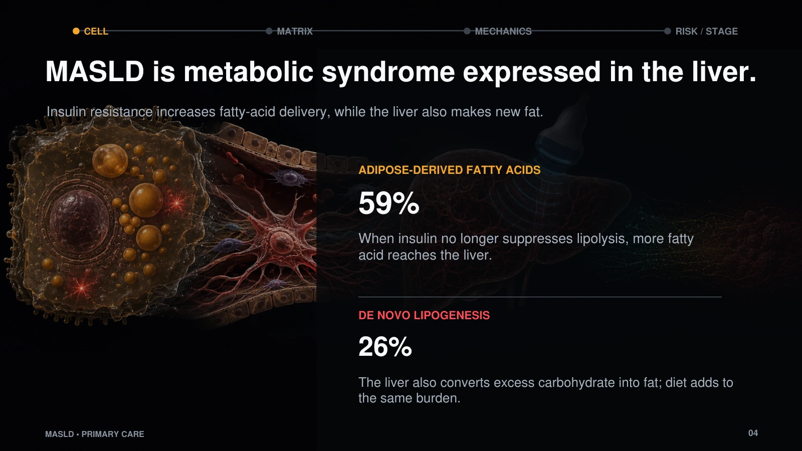 Slide 4: MASLD is metabolic syndrome expressed in the liver.