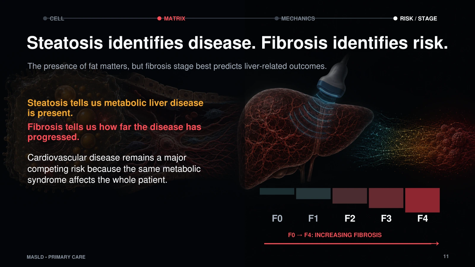 Slide 11: Steatosis identifies disease. Fibrosis identifies risk.